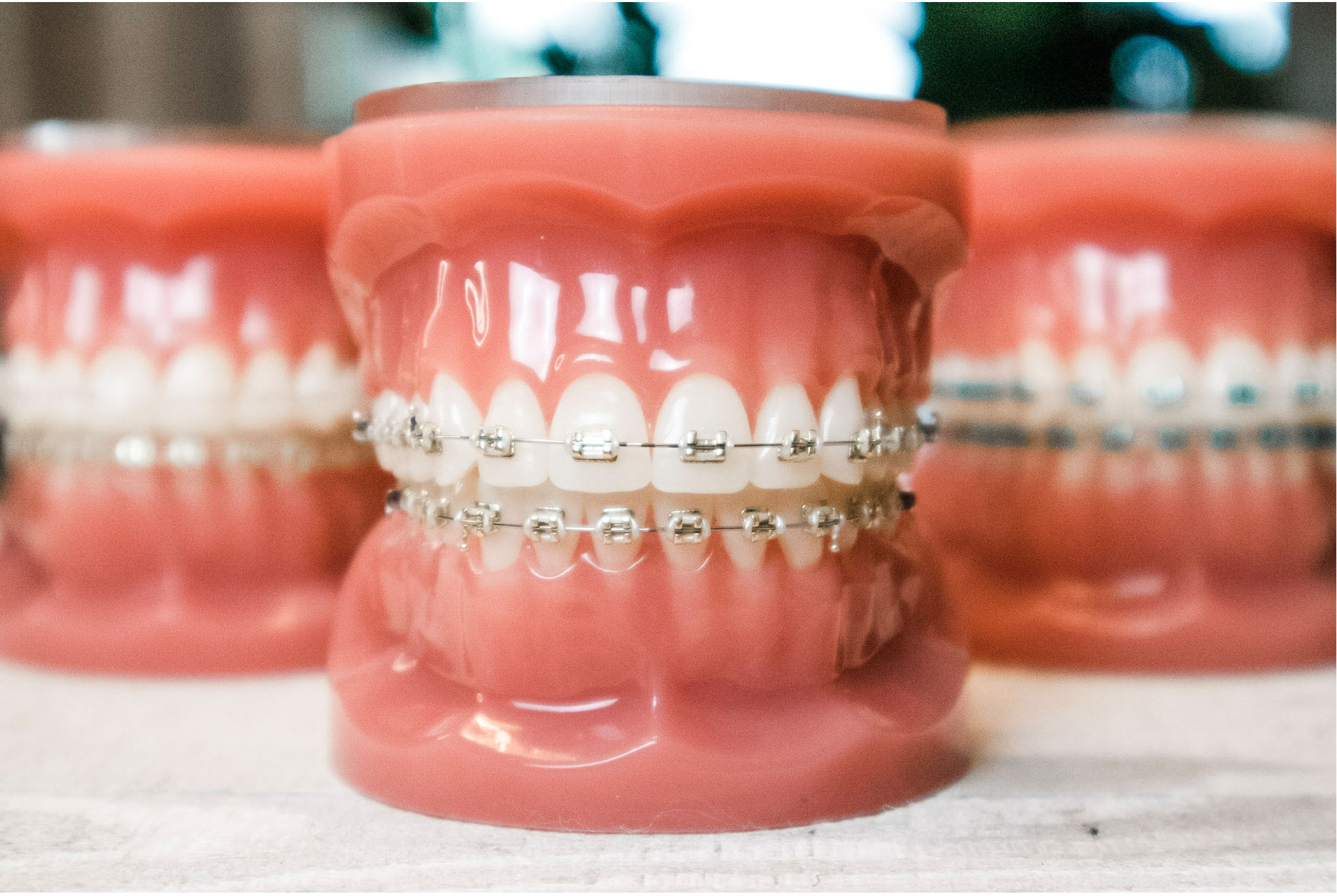 braces
