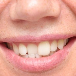 McAllen orthodontist near me