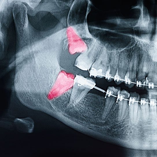 Freels Orthodontics -