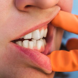 Freels Orthodontics -