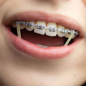 Freels Orthodontics -