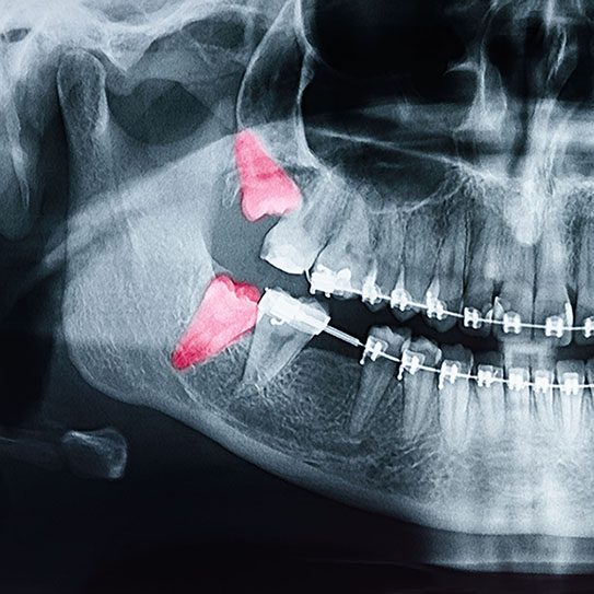 Freels Orthodontics -