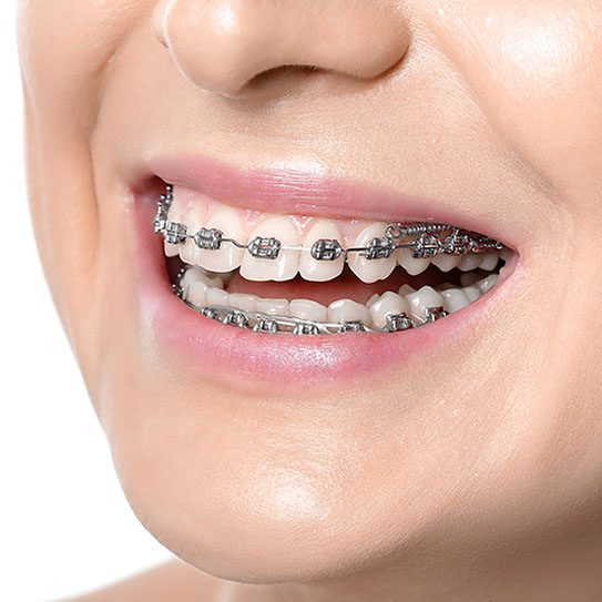 Freels Orthodontics -