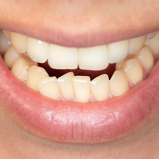 Freels Orthodontics -